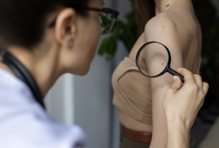 Prevenção ao Câncer de Pele